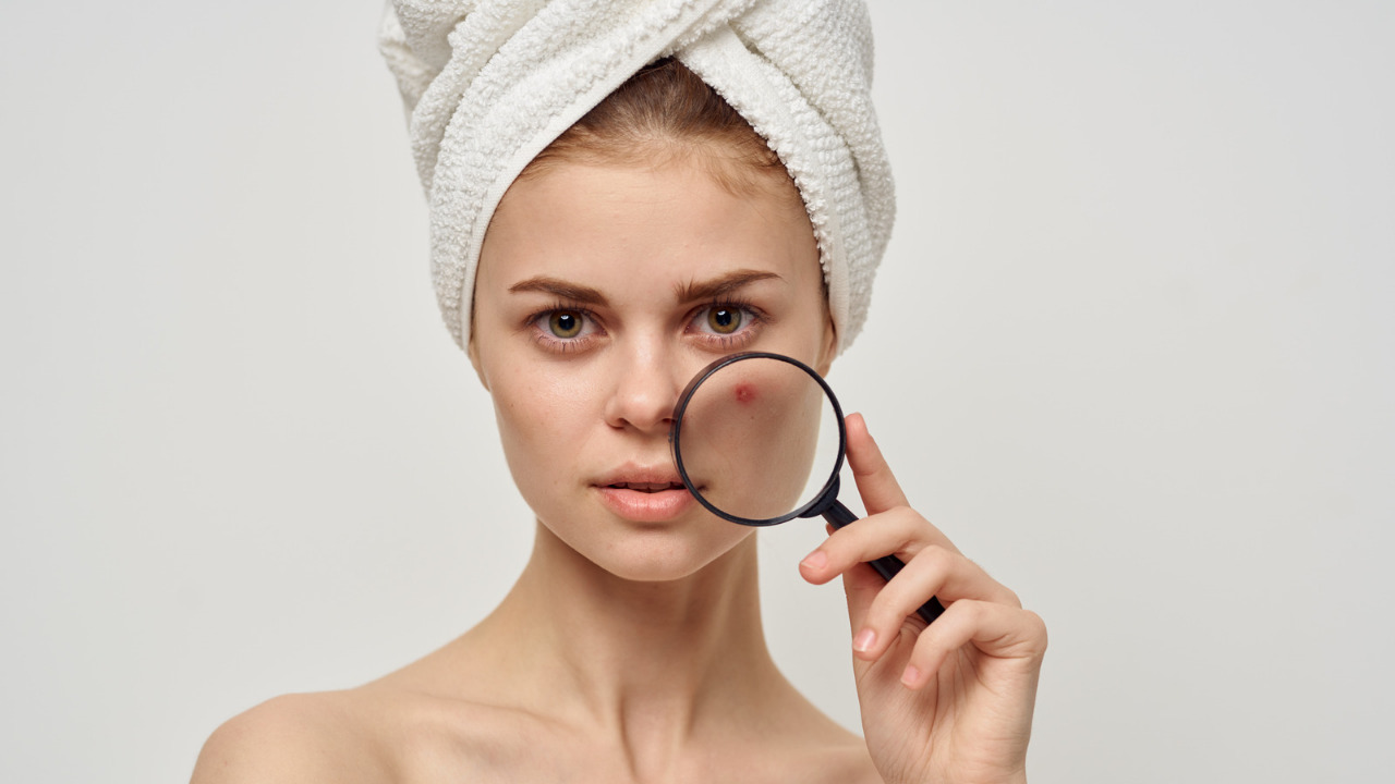 tretman lica protiv akni i za masnu kozu