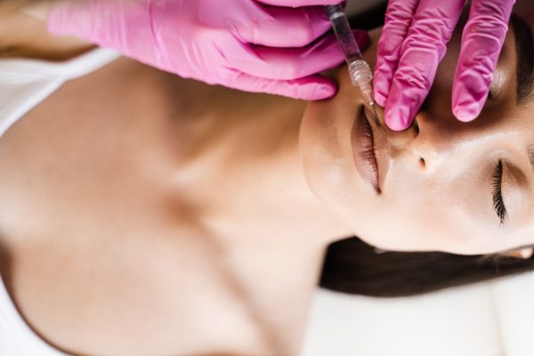 Koliko traje otok posle hijaluronskih filera u usnama? – Očekivani tok oporavka po&nbsp;danima