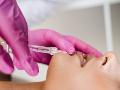 Koliko traje oporavak nakon uvećanja&nbsp;usana?