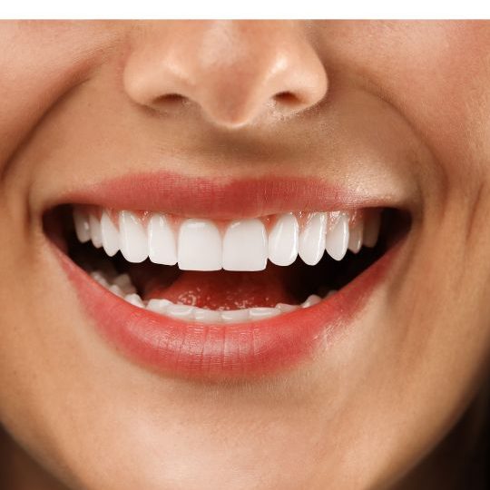 Šta su Bezmetalne Krunice i Koje su Njihove&nbsp;Prednosti?