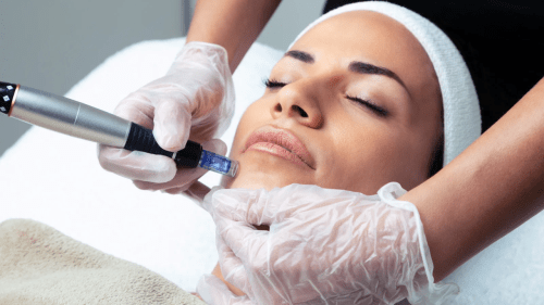 Započnite profesionalnu negu kože sa&nbsp;Dermapenom