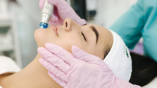 dermapen tretman lica