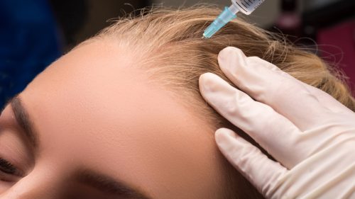 medicinski tretmani kose vracar