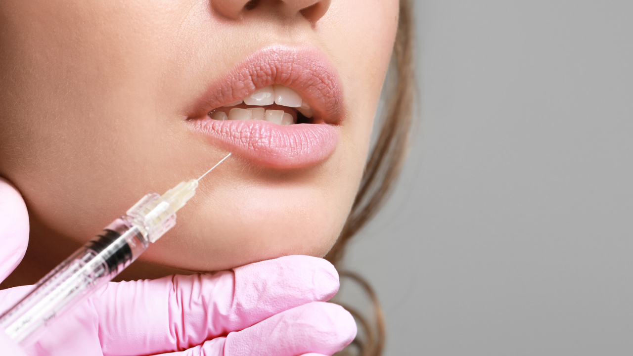 hijaluronski fileri uvecanje usana