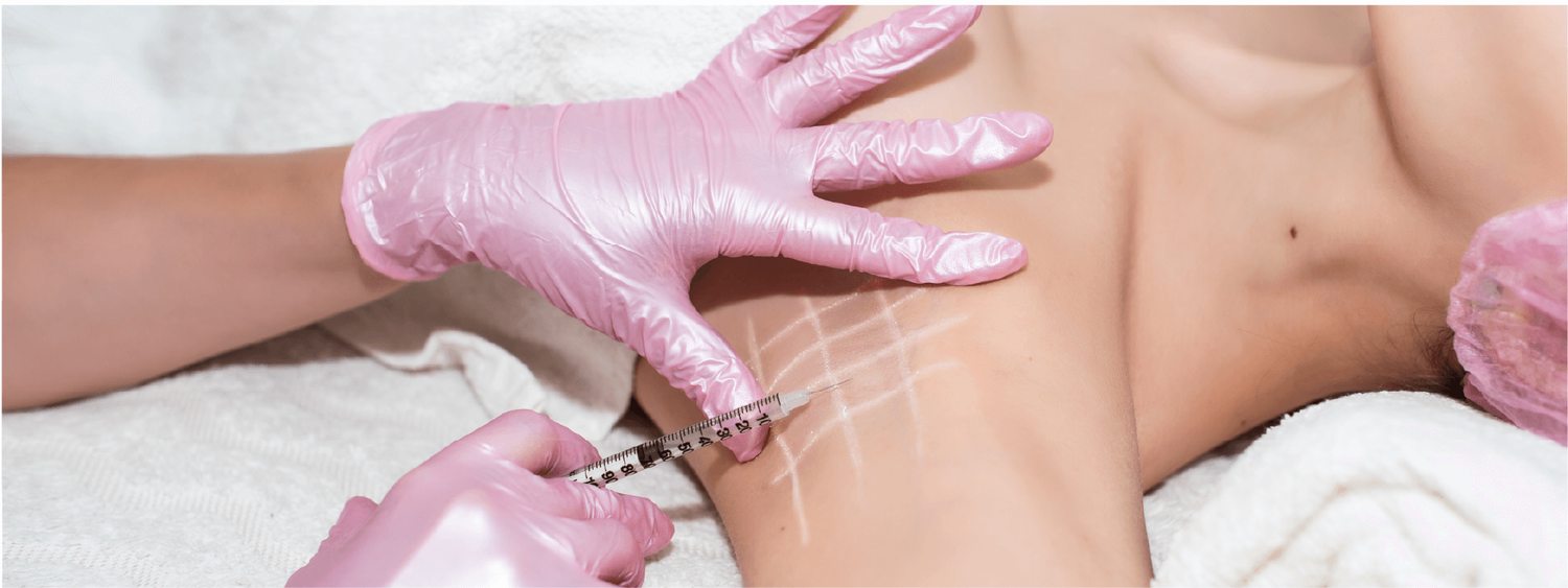 tretman pojacanog znojenja ili hiperhidroze