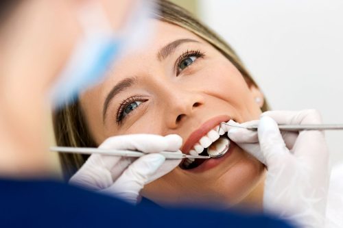 Kako Mogu da Sprečim Nastanak Zubnog Kamenca? Vodič za Zdrav i Blistav&nbsp;Osmeh