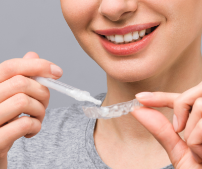 kucno izbeljivanje zuba